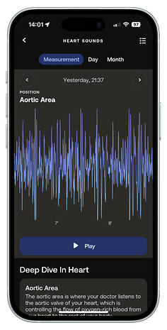 Screen displaying heart sounds measurement with a graph and details about the aortic area.