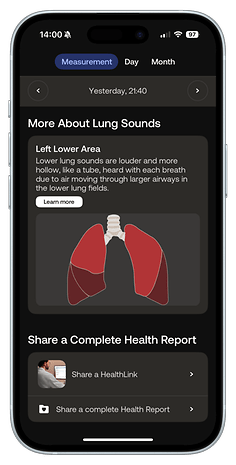 Screenshot of Withings BeamO app showing lung sounds measurement and health report options.