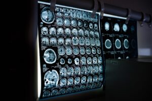AI tools for analyzing medical imaging data