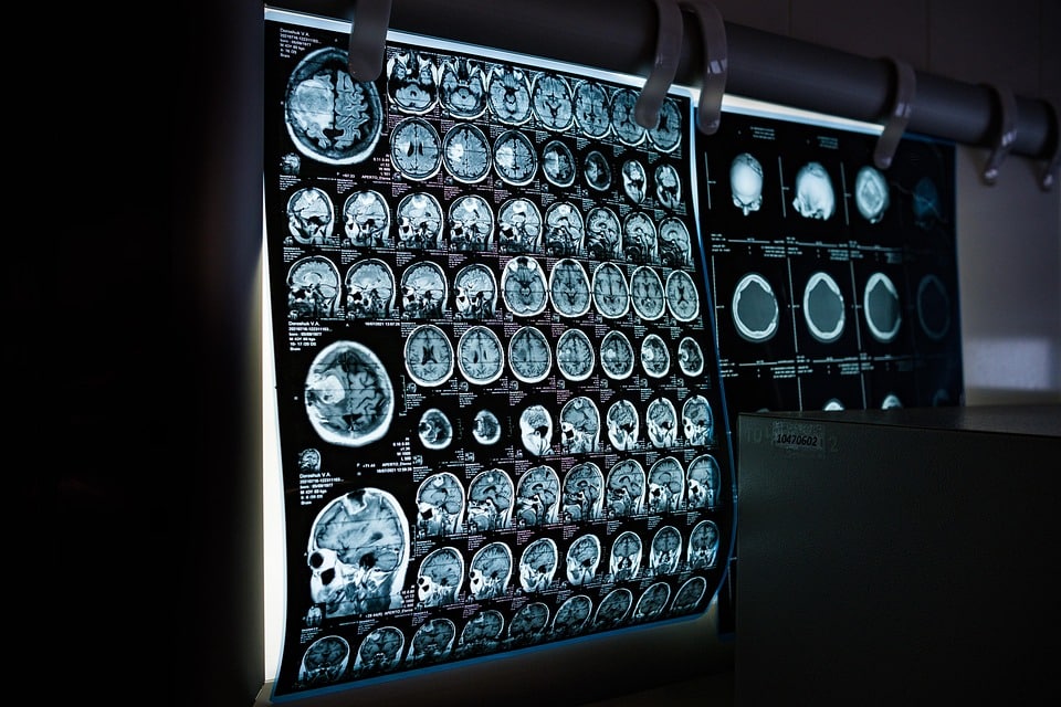 AI tools for analyzing medical imaging data
