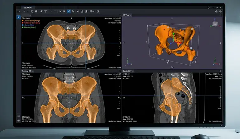 A Practical Guide to Bone Tissue Labeling and Annotation 7 MONAI Label