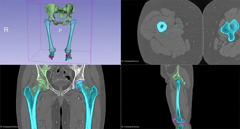 A Practical Guide to Bone Tissue Labeling and Annotation 2 Bone annotation